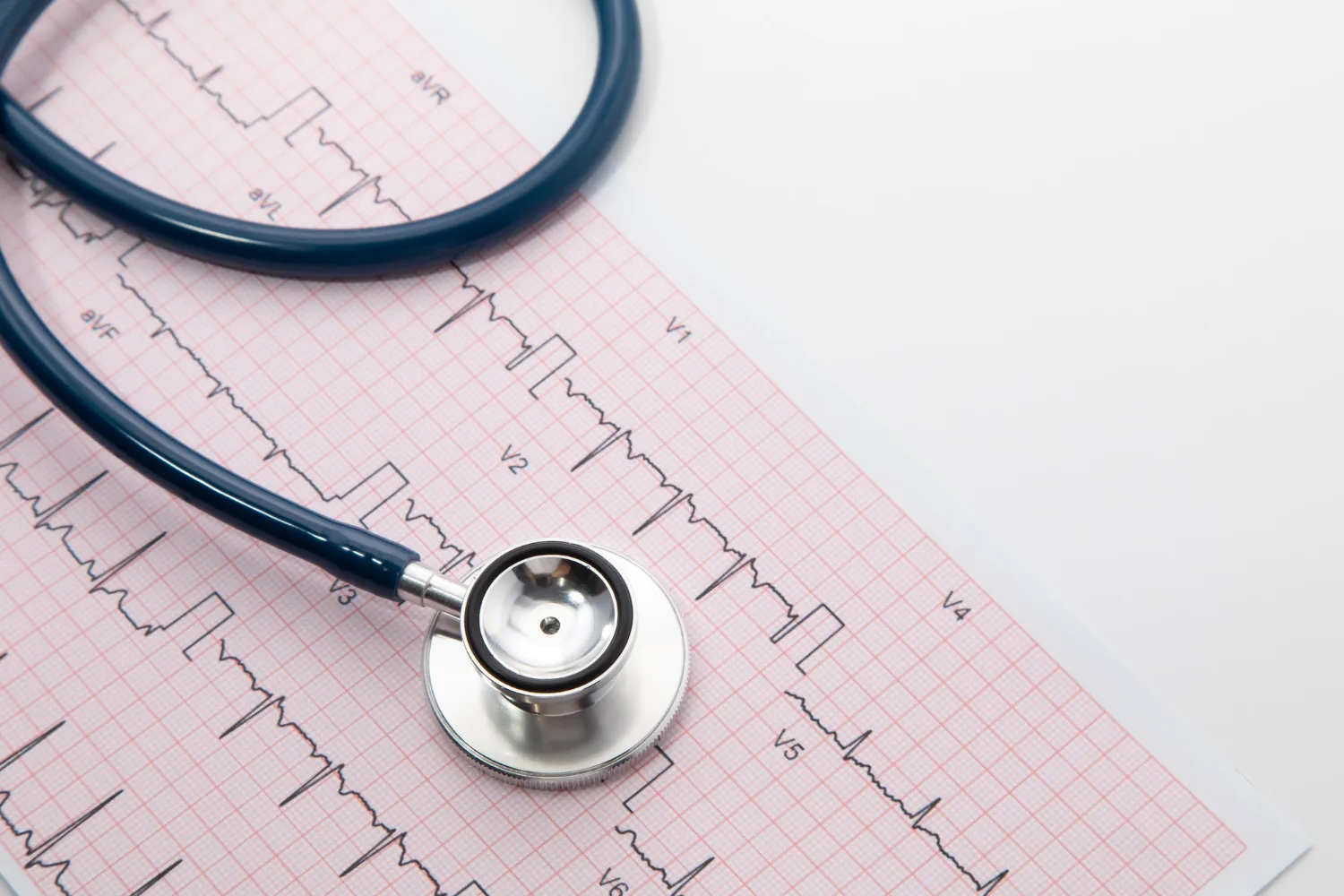 Electrocardiograma en CDMX: Diagnóstico preciso para tu corazón